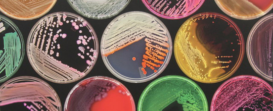 Petri dishes with cultures of bacteria grown on agar jelly 